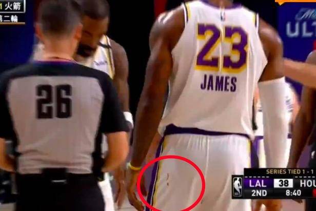 
詹姆斯两罚全丢 哈登助威少空接暴扣 湖人悍将出血染詹皇球裤【ky开元电竞】(图6)